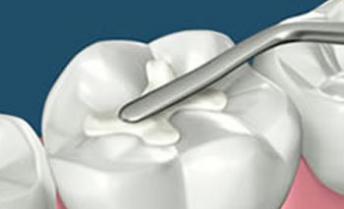 Department Of Conservative Dentistry Endodontics