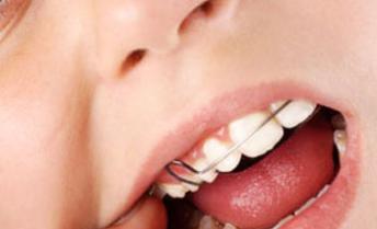 Department Of Pediatric & Preventive Dentistry