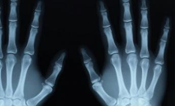 Department of Radiodiagnosis